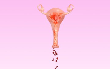 Será que é possível voltar a menstruar dois anos após a menopausa? - iStock